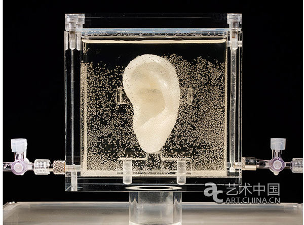 Van Gogh kann wieder h?ren