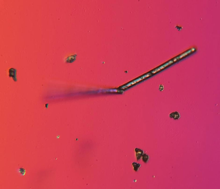 Smog unter dem Mikroskop